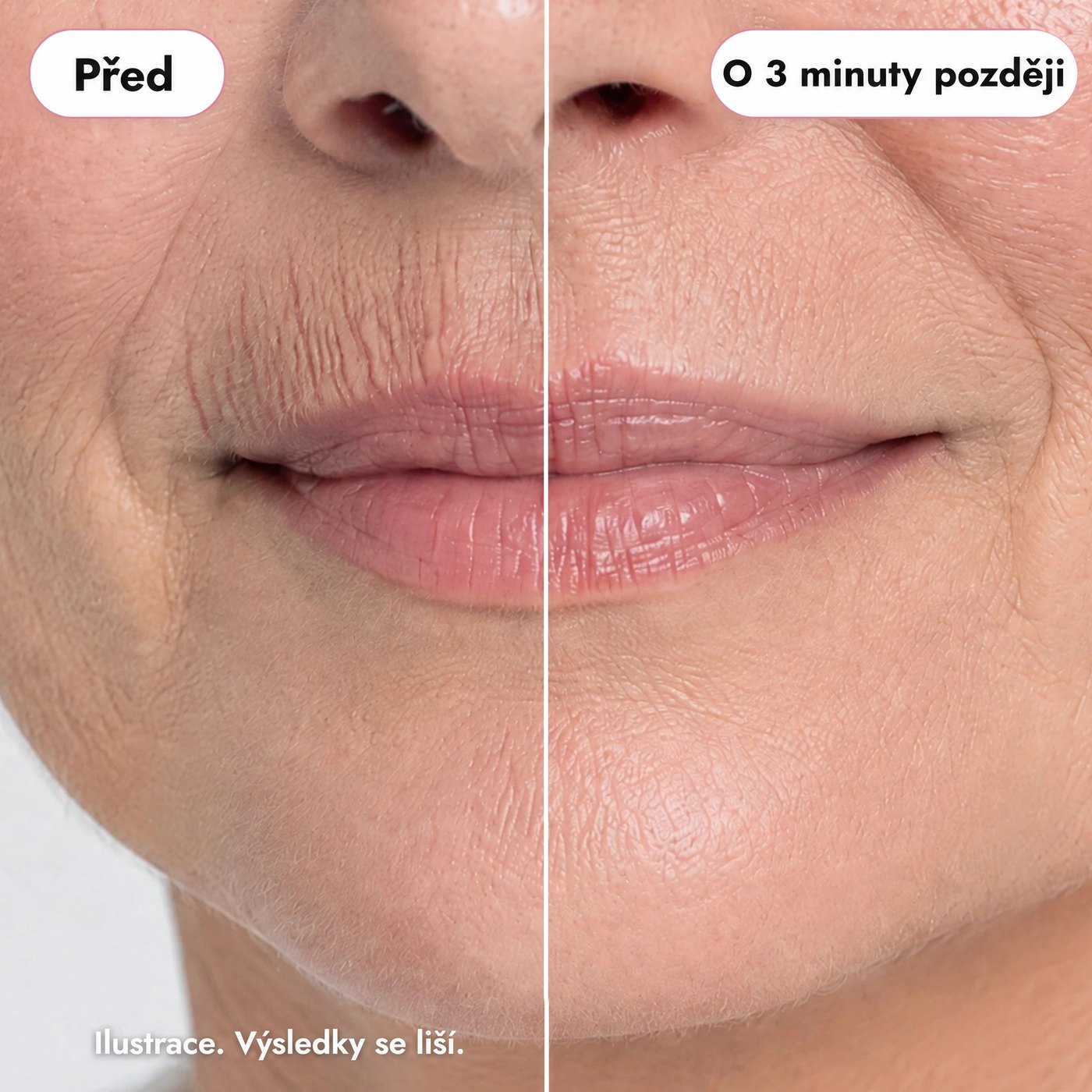 Před a po 3 minutách: vrásky nad horním rtem